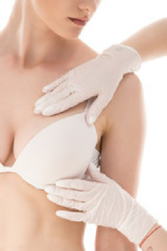 Mamoplastia de Aumento Cirurgia Ribeirão Pires - Mamoplastia Levantamento