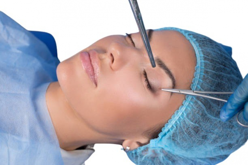 Onde Fazer Cirurgia de Blefaroplastia a Laser Caieiras - Cirurgia Pálpebras