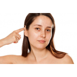 cirurgia de orelha de abano Vila Prudente