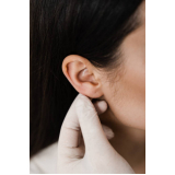cirurgia de redução de orelha perto de mim ARUJÁ