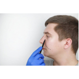 cirurgia para afinar o nariz Pacaembu