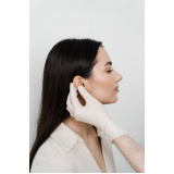 cirurgia para retirar orelha de abano Pinheiros