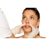clínica especializada em tratamento de rejuvenescimento para o rosto Consolação