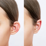 clínica que faz cirurgia para diminuir a orelha Barueri