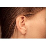 clínica que faz cirurgia para orelha de abano GRANJA VIANA