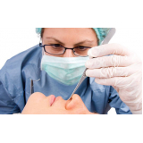 clínica que faz rinoplastia nariz de batata GRANJA VIANA