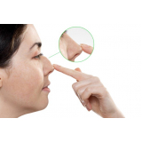 clínica que faz rinoplastia para diminuir o nariz Siciliano