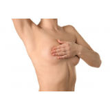 mamoplastia com prótese cirurgia Salesópolis