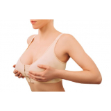 mamoplastia redutora sem prótese Pinheiros