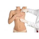 mamoplastia sem silicone cirurgia São Bernardo Centro