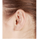 onde fazer cirurgia de orelha de abano Juquitiba